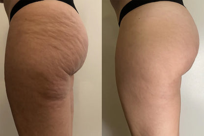 Adeus Cellulite Cream